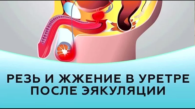 Резь и жжение в уретре после эякуляции