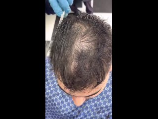 Hass Barber - Mens hairstyles #bestbarber #iran #hairremoval #school #barber #tutorial