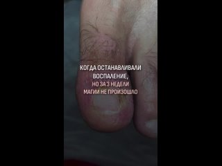 Видео от ПедикюрподологманикюрОбнинск
