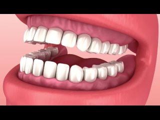 Видео от Центр семейной стоматологии «Аполлония» | Екб