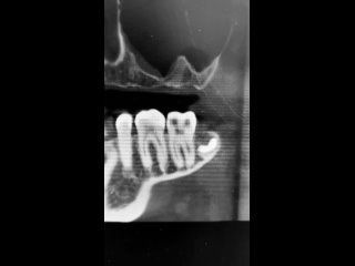 Видео от Семейная стоматологическая клиника New Smile