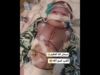 Los mdicos luchan por la vida de un beb que sufri graves lesiones debido a los ataques israelies