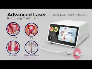 Hemorrhoids proctology laser machine 1470nm 980nm diode laser TRANGEL TR-B