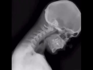 Метод рентгеновской визуализации позволяет визуализировать анатомию в движении.
