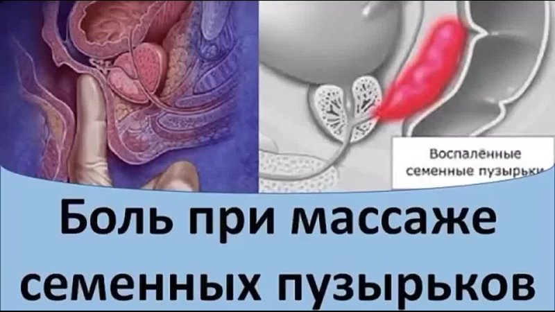 Боль при массаже семенных