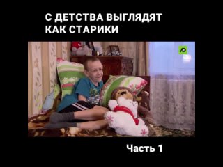 С детства выглядят как старики