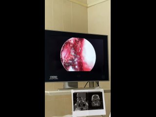 Відео від ЛОР-хирургия с доктором Белозёровым