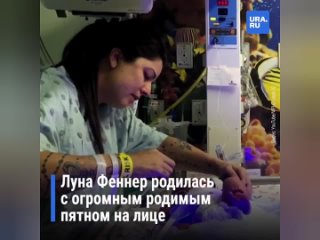 Девочка из США с «маской Бэтмена» продолжит лечение в России