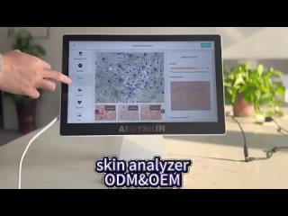 Owning this skin analyzer = having a professional skin doctor_ What are you waiting for  the price is favorable_ Limited quan___