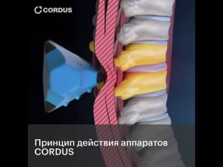 ПРИНЦИП ДЕЙСТВИЯ АППАРАТОВ CORDUS