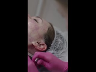 Video by Estet Cosmetology|Препараты для косметологов