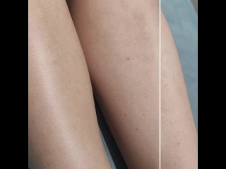 Видео от Врач-косметолог Ирина Муштук Самара