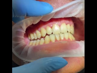 Видео от Доктор Петрова. Семейный стоматолог.