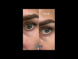 Видео от Для женщин: процедуры/косметика/БАДы Ростов н/Д