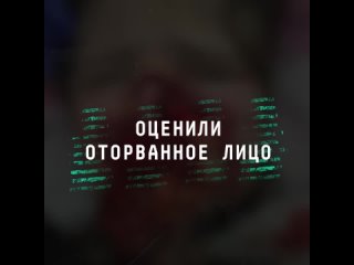 Краснодарский хирург предлагает деньги за информацию о судьбе лица девочки, на которую напала собака