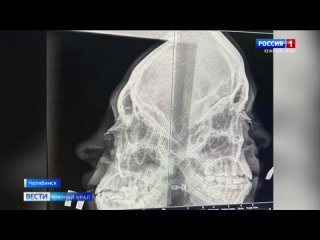 В Челябинске задержали мужчину, который сломал нос сотруднице бара