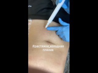 Vdeo de Beauty Studio ХОЛОДНАЯ ПЛАЗМА