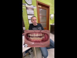 Отзыв пациента_тотальное протезирование зубов. НовоДент Орджоникидзе, 21_ Яцук А. В.
