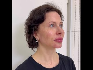 Видео от Врач дерматокосметолог Лисицына Наталья Петровна