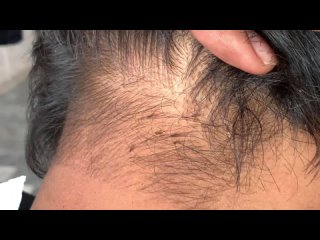 Jami Hair Salon - How to get of Lice Remove, Scissors Hair Cuting. [tutorial]ASMR