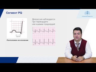 ЭКГ: алгоритм интерпретации. Сегмент PQ