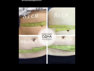 Видео от Массаж & Аппаратная косметология #массажбалтийск
