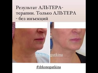 Video by Клиника Доктора Конопаткиной | Киров
