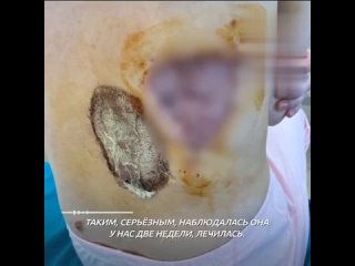 Кадры не для слабонервных: дыра и ожог размером с кулак остались на теле россиянки после посещения гинеколога в ТюмениВрач пр