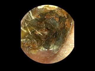 Мерзость🤢, но залипательная🤤