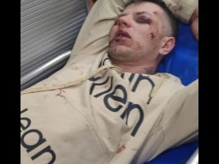 В Ростове-на-Дону задержали троих мужчин, которые избили участника СВО и его жену.