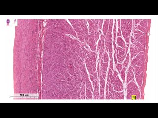 [Osteoclassno] Сердечно-сосудистая система. Препарат Сердце. Гистологическое строение стенки сердца.