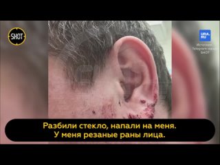 Пострадавший от нападения, экс-полицейский из Перми рассказал о травмах