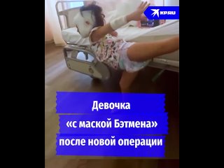 «Я этого долго избегала!». Мама девочки «с маской Бэтмена» показала ее после новой операции в России