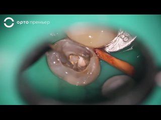 Видео от Клиника эстетической стоматологии «Орто-Премьер»