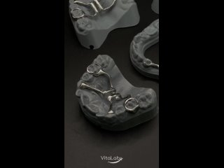 Несъемные ортодонтические аппараты VitaLab