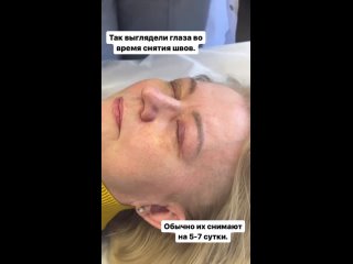 Видео от Пластический хирург Гогохия Тамара Спб
