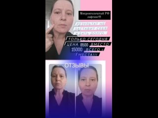 Видео от Похудение LPG Аппаратный  массаж Евпатория