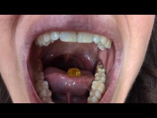 Woman with big mouth swallows a gummy bear whole