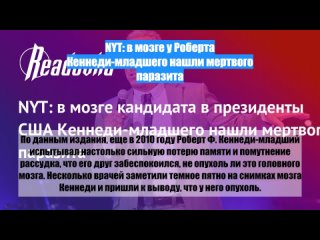 NYT: вмозге уРоберта Кеннеди-младшего нашли мертвого паразита