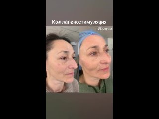 Video by Елена косметолог Москва