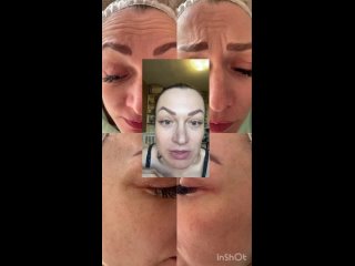 Видео от Врач - косметолог,дерматолог Сестрорецк (СПБ)