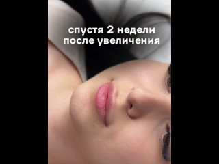 Video by Косметолог | Ксения Бычок | Челябинск