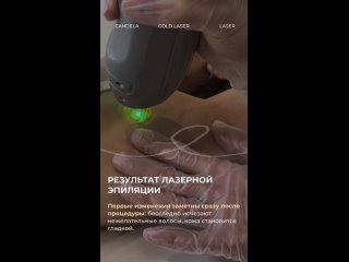 Видео от Лазерная эпиляция Липецк