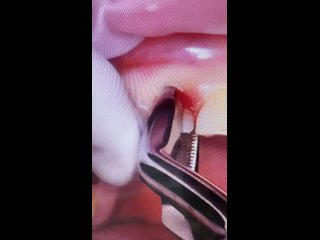 Видео от Курсы для стоматологов|Учебный центр для врачей