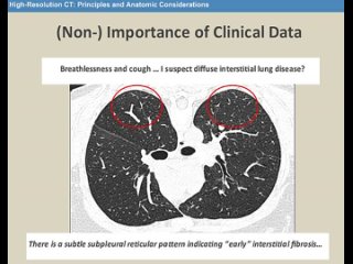 2013 High-Resolution CT - A Pattern-based Approach (An Interactive Session)