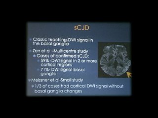 CJD - prion disease in RANZCR Educational Video Presentations - Radiology and Radiation Oncology on Vimeo