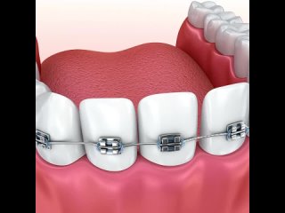 Стоматология в Гомеле Красивые зубыtan video