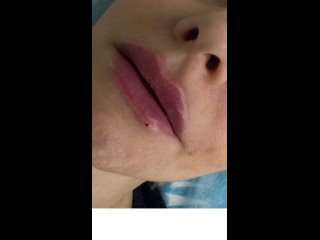 Видео от Врач-косметолог Ами Пак