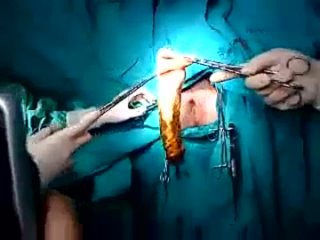 Андрей Моисеев (Великий Новгород) попал в больницу