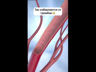 Новые технологии в медицине (видео)